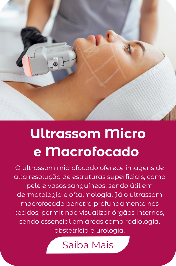 Inserir um título (1)